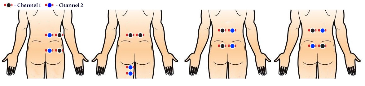 Correct Placement for Your TENS Machines Electrode Pads ...