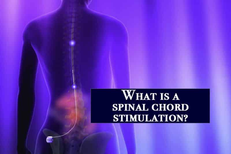 spinal cord stimulator reviews spinal cord stimulator reviews